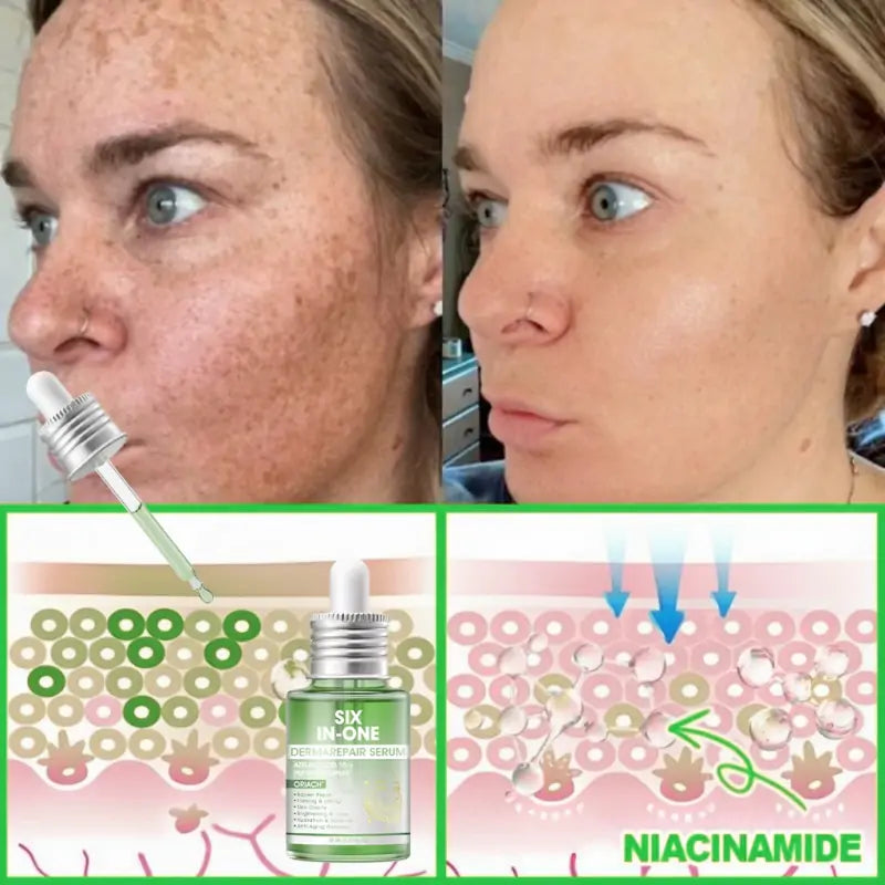 𝐎𝐫𝐢𝐚𝐜𝐡® 𝐀𝟏𝟎+ 𝟔-𝐢𝐧-𝟏 𝐃𝐞𝐫𝐦𝐚𝐑𝐞𝐩𝐚𝐢𝐫 𝐒𝐞𝐫𝐮𝐦 🇮🇪 𝐇𝐒𝐄 & 𝐄𝐔-𝐆𝐌𝐏 𝐂𝐞𝐫𝐭𝐢𝐟𝐢𝐞𝐝 – 𝐅𝐢𝐫𝐦𝐬 𝐥𝐨𝐨𝐬𝐞 𝐬𝐤𝐢𝐧, 𝐫𝐞𝐝𝐮𝐜𝐞𝐬 𝐛𝐫𝐮𝐢𝐬𝐢𝐧𝐠 𝐚𝐧𝐝 𝐚𝐠𝐞-𝐫𝐞𝐥𝐚𝐭𝐞𝐝 𝐬𝐤𝐢𝐧 𝐝𝐢𝐬𝐜𝐨𝐥𝐨𝐮𝐫𝐚𝐭𝐢𝐨𝐧, 𝐚𝐧𝐝 𝐭𝐫𝐞𝐚𝐭𝐬 𝐤𝐞𝐫𝐚𝐭𝐢𝐧 𝐛𝐮𝐢𝐥𝐝𝐮𝐩, 𝐬𝐞𝐛𝐨𝐫𝐫𝐡𝐨𝐞𝐢𝐜 𝐝𝐞𝐫𝐦𝐚𝐭𝐢𝐭𝐢𝐬, 𝐚𝐧𝐝 𝐟𝐨𝐥𝐥𝐢𝐜𝐮𝐥𝐚𝐫 𝐤𝐞𝐫𝐚𝐭𝐨𝐬𝐢𝐬.