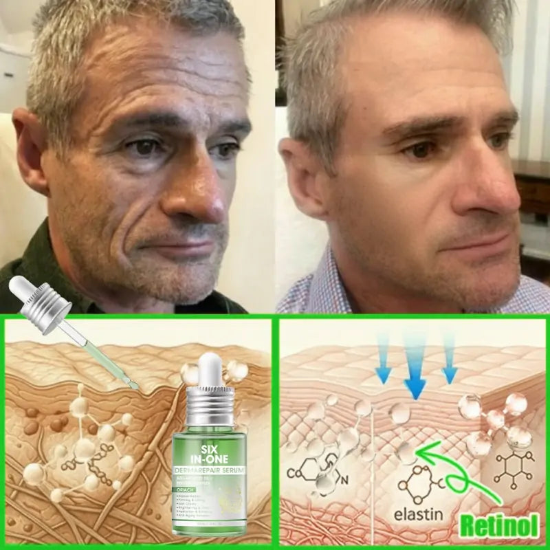 𝐎𝐫𝐢𝐚𝐜𝐡® 𝐀𝟏𝟎+ 𝟔-𝐢𝐧-𝟏 𝐃𝐞𝐫𝐦𝐚𝐑𝐞𝐩𝐚𝐢𝐫 𝐒𝐞𝐫𝐮𝐦 🇮🇪 𝐇𝐒𝐄 & 𝐄𝐔-𝐆𝐌𝐏 𝐂𝐞𝐫𝐭𝐢𝐟𝐢𝐞𝐝 – 𝐅𝐢𝐫𝐦𝐬 𝐥𝐨𝐨𝐬𝐞 𝐬𝐤𝐢𝐧, 𝐫𝐞𝐝𝐮𝐜𝐞𝐬 𝐛𝐫𝐮𝐢𝐬𝐢𝐧𝐠 𝐚𝐧𝐝 𝐚𝐠𝐞-𝐫𝐞𝐥𝐚𝐭𝐞𝐝 𝐬𝐤𝐢𝐧 𝐝𝐢𝐬𝐜𝐨𝐥𝐨𝐮𝐫𝐚𝐭𝐢𝐨𝐧, 𝐚𝐧𝐝 𝐭𝐫𝐞𝐚𝐭𝐬 𝐤𝐞𝐫𝐚𝐭𝐢𝐧 𝐛𝐮𝐢𝐥𝐝𝐮𝐩, 𝐬𝐞𝐛𝐨𝐫𝐫𝐡𝐨𝐞𝐢𝐜 𝐝𝐞𝐫𝐦𝐚𝐭𝐢𝐭𝐢𝐬, 𝐚𝐧𝐝 𝐟𝐨𝐥𝐥𝐢𝐜𝐮𝐥𝐚𝐫 𝐤𝐞𝐫𝐚𝐭𝐨𝐬𝐢𝐬.