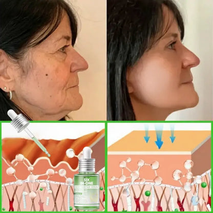 𝐎𝐫𝐢𝐚𝐜𝐡® 𝐀𝟏𝟎+ 𝟔-𝐢𝐧-𝟏 𝐃𝐞𝐫𝐦𝐚𝐑𝐞𝐩𝐚𝐢𝐫 𝐒𝐞𝐫𝐮𝐦 🇮🇪 𝐇𝐒𝐄 & 𝐄𝐔-𝐆𝐌𝐏 𝐂𝐞𝐫𝐭𝐢𝐟𝐢𝐞𝐝 – 𝐅𝐢𝐫𝐦𝐬 𝐥𝐨𝐨𝐬𝐞 𝐬𝐤𝐢𝐧, 𝐫𝐞𝐝𝐮𝐜𝐞𝐬 𝐛𝐫𝐮𝐢𝐬𝐢𝐧𝐠 𝐚𝐧𝐝 𝐚𝐠𝐞-𝐫𝐞𝐥𝐚𝐭𝐞𝐝 𝐬𝐤𝐢𝐧 𝐝𝐢𝐬𝐜𝐨𝐥𝐨𝐮𝐫𝐚𝐭𝐢𝐨𝐧, 𝐚𝐧𝐝 𝐭𝐫𝐞𝐚𝐭𝐬 𝐤𝐞𝐫𝐚𝐭𝐢𝐧 𝐛𝐮𝐢𝐥𝐝𝐮𝐩, 𝐬𝐞𝐛𝐨𝐫𝐫𝐡𝐨𝐞𝐢𝐜 𝐝𝐞𝐫𝐦𝐚𝐭𝐢𝐭𝐢𝐬, 𝐚𝐧𝐝 𝐟𝐨𝐥𝐥𝐢𝐜𝐮𝐥𝐚𝐫 𝐤𝐞𝐫𝐚𝐭𝐨𝐬𝐢𝐬.