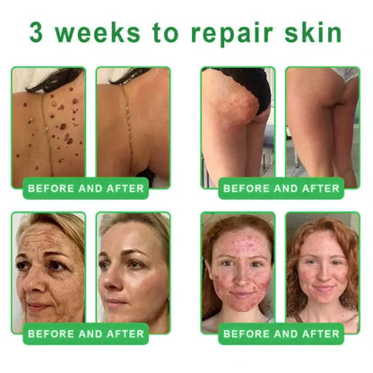 𝐎𝐫𝐢𝐚𝐜𝐡® 𝐀𝟏𝟎+ 𝟔-𝐢𝐧-𝟏 𝐃𝐞𝐫𝐦𝐚𝐑𝐞𝐩𝐚𝐢𝐫 𝐒𝐞𝐫𝐮𝐦 🇮🇪 𝐇𝐒𝐄 & 𝐄𝐔-𝐆𝐌𝐏 𝐂𝐞𝐫𝐭𝐢𝐟𝐢𝐞𝐝 – 𝐅𝐢𝐫𝐦𝐬 𝐥𝐨𝐨𝐬𝐞 𝐬𝐤𝐢𝐧, 𝐫𝐞𝐝𝐮𝐜𝐞𝐬 𝐛𝐫𝐮𝐢𝐬𝐢𝐧𝐠 𝐚𝐧𝐝 𝐚𝐠𝐞-𝐫𝐞𝐥𝐚𝐭𝐞𝐝 𝐬𝐤𝐢𝐧 𝐝𝐢𝐬𝐜𝐨𝐥𝐨𝐮𝐫𝐚𝐭𝐢𝐨𝐧, 𝐚𝐧𝐝 𝐭𝐫𝐞𝐚𝐭𝐬 𝐤𝐞𝐫𝐚𝐭𝐢𝐧 𝐛𝐮𝐢𝐥𝐝𝐮𝐩, 𝐬𝐞𝐛𝐨𝐫𝐫𝐡𝐨𝐞𝐢𝐜 𝐝𝐞𝐫𝐦𝐚𝐭𝐢𝐭𝐢𝐬, 𝐚𝐧𝐝 𝐟𝐨𝐥𝐥𝐢𝐜𝐮𝐥𝐚𝐫 𝐤𝐞𝐫𝐚𝐭𝐨𝐬𝐢𝐬.