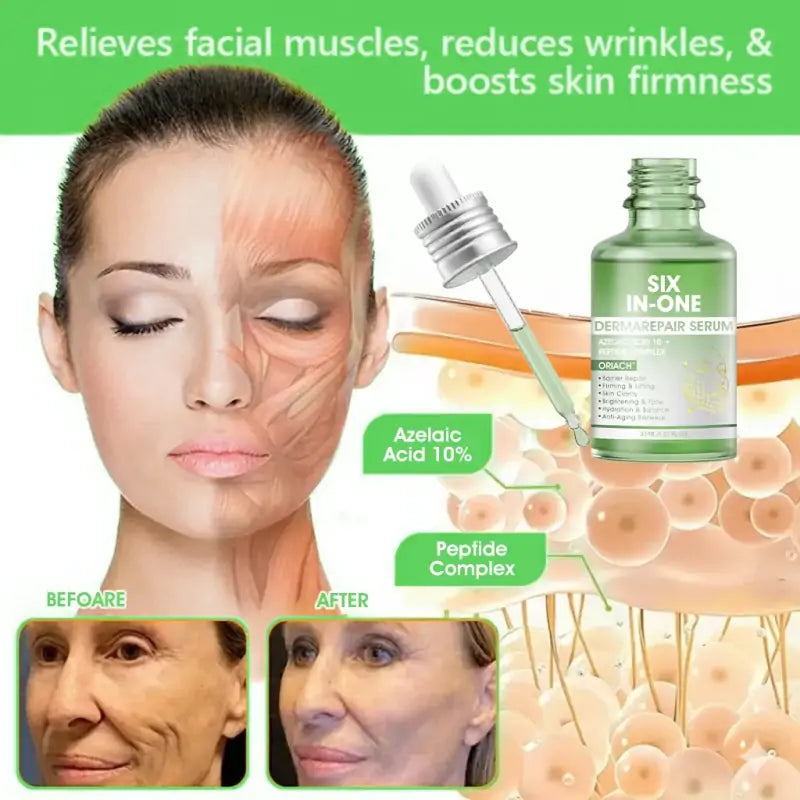 𝐎𝐫𝐢𝐚𝐜𝐡® 𝐀𝟏𝟎+ 𝟔-𝐢𝐧-𝟏 𝐃𝐞𝐫𝐦𝐚𝐑𝐞𝐩𝐚𝐢𝐫 𝐒𝐞𝐫𝐮𝐦 🇮🇪 𝐇𝐒𝐄 & 𝐄𝐔-𝐆𝐌𝐏 𝐂𝐞𝐫𝐭𝐢𝐟𝐢𝐞𝐝 – 𝐅𝐢𝐫𝐦𝐬 𝐥𝐨𝐨𝐬𝐞 𝐬𝐤𝐢𝐧, 𝐫𝐞𝐝𝐮𝐜𝐞𝐬 𝐛𝐫𝐮𝐢𝐬𝐢𝐧𝐠 𝐚𝐧𝐝 𝐚𝐠𝐞-𝐫𝐞𝐥𝐚𝐭𝐞𝐝 𝐬𝐤𝐢𝐧 𝐝𝐢𝐬𝐜𝐨𝐥𝐨𝐮𝐫𝐚𝐭𝐢𝐨𝐧, 𝐚𝐧𝐝 𝐭𝐫𝐞𝐚𝐭𝐬 𝐤𝐞𝐫𝐚𝐭𝐢𝐧 𝐛𝐮𝐢𝐥𝐝𝐮𝐩, 𝐬𝐞𝐛𝐨𝐫𝐫𝐡𝐨𝐞𝐢𝐜 𝐝𝐞𝐫𝐦𝐚𝐭𝐢𝐭𝐢𝐬, 𝐚𝐧𝐝 𝐟𝐨𝐥𝐥𝐢𝐜𝐮𝐥𝐚𝐫 𝐤𝐞𝐫𝐚𝐭𝐨𝐬𝐢𝐬.