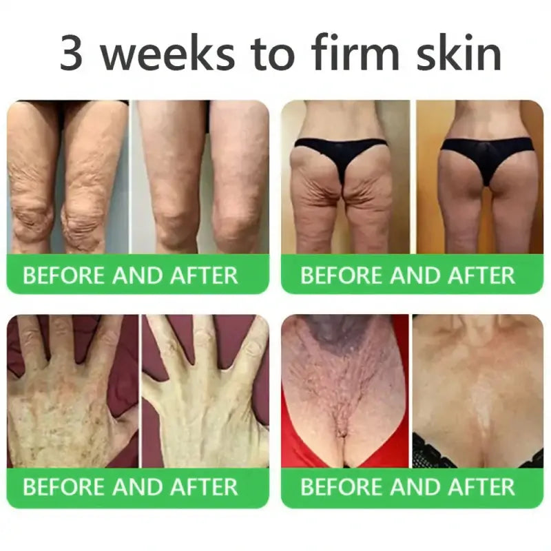 𝐎𝐫𝐢𝐚𝐜𝐡® 𝐀𝟏𝟎+ 𝟔-𝐢𝐧-𝟏 𝐃𝐞𝐫𝐦𝐚𝐑𝐞𝐩𝐚𝐢𝐫 𝐒𝐞𝐫𝐮𝐦 🇮🇪 𝐇𝐒𝐄 & 𝐄𝐔-𝐆𝐌𝐏 𝐂𝐞𝐫𝐭𝐢𝐟𝐢𝐞𝐝 – 𝐅𝐢𝐫𝐦𝐬 𝐥𝐨𝐨𝐬𝐞 𝐬𝐤𝐢𝐧, 𝐫𝐞𝐝𝐮𝐜𝐞𝐬 𝐛𝐫𝐮𝐢𝐬𝐢𝐧𝐠 𝐚𝐧𝐝 𝐚𝐠𝐞-𝐫𝐞𝐥𝐚𝐭𝐞𝐝 𝐬𝐤𝐢𝐧 𝐝𝐢𝐬𝐜𝐨𝐥𝐨𝐮𝐫𝐚𝐭𝐢𝐨𝐧, 𝐚𝐧𝐝 𝐭𝐫𝐞𝐚𝐭𝐬 𝐤𝐞𝐫𝐚𝐭𝐢𝐧 𝐛𝐮𝐢𝐥𝐝𝐮𝐩, 𝐬𝐞𝐛𝐨𝐫𝐫𝐡𝐨𝐞𝐢𝐜 𝐝𝐞𝐫𝐦𝐚𝐭𝐢𝐭𝐢𝐬, 𝐚𝐧𝐝 𝐟𝐨𝐥𝐥𝐢𝐜𝐮𝐥𝐚𝐫 𝐤𝐞𝐫𝐚𝐭𝐨𝐬𝐢𝐬.