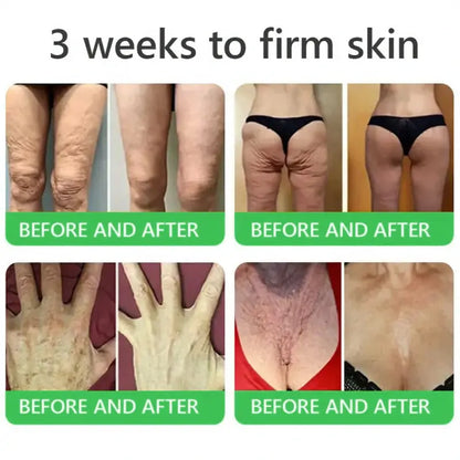 𝐎𝐫𝐢𝐚𝐜𝐡® 𝐀𝟏𝟎+ 𝟔-𝐢𝐧-𝟏 𝐃𝐞𝐫𝐦𝐚𝐑𝐞𝐩𝐚𝐢𝐫 𝐒𝐞𝐫𝐮𝐦 🇮🇪 𝐇𝐒𝐄 & 𝐄𝐔-𝐆𝐌𝐏 𝐂𝐞𝐫𝐭𝐢𝐟𝐢𝐞𝐝 – 𝐅𝐢𝐫𝐦𝐬 𝐥𝐨𝐨𝐬𝐞 𝐬𝐤𝐢𝐧, 𝐫𝐞𝐝𝐮𝐜𝐞𝐬 𝐛𝐫𝐮𝐢𝐬𝐢𝐧𝐠 𝐚𝐧𝐝 𝐚𝐠𝐞-𝐫𝐞𝐥𝐚𝐭𝐞𝐝 𝐬𝐤𝐢𝐧 𝐝𝐢𝐬𝐜𝐨𝐥𝐨𝐮𝐫𝐚𝐭𝐢𝐨𝐧, 𝐚𝐧𝐝 𝐭𝐫𝐞𝐚𝐭𝐬 𝐤𝐞𝐫𝐚𝐭𝐢𝐧 𝐛𝐮𝐢𝐥𝐝𝐮𝐩, 𝐬𝐞𝐛𝐨𝐫𝐫𝐡𝐨𝐞𝐢𝐜 𝐝𝐞𝐫𝐦𝐚𝐭𝐢𝐭𝐢𝐬, 𝐚𝐧𝐝 𝐟𝐨𝐥𝐥𝐢𝐜𝐮𝐥𝐚𝐫 𝐤𝐞𝐫𝐚𝐭𝐨𝐬𝐢𝐬.