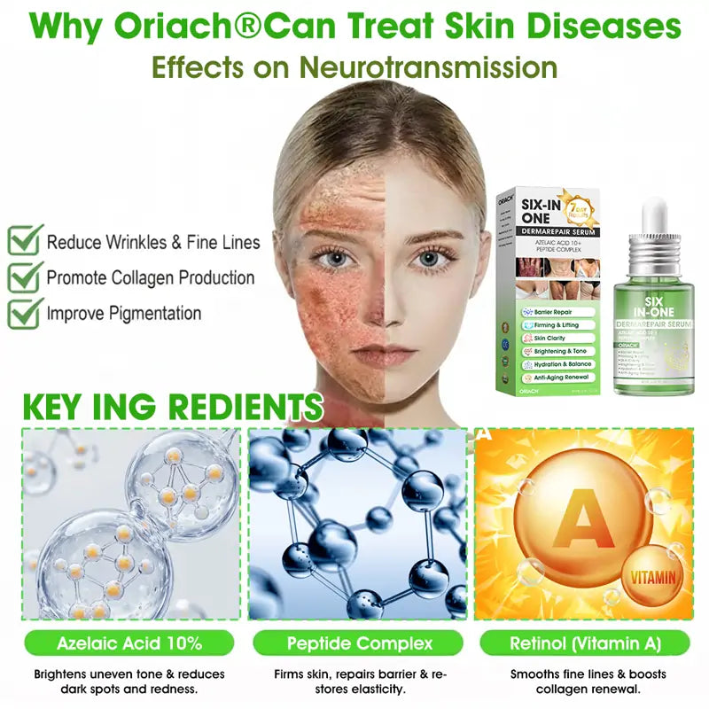 𝐎𝐫𝐢𝐚𝐜𝐡® 𝐀𝟏𝟎+ 𝟔-𝐢𝐧-𝟏 𝐃𝐞𝐫𝐦𝐚𝐑𝐞𝐩𝐚𝐢𝐫 𝐒𝐞𝐫𝐮𝐦 🇮🇪 𝐇𝐒𝐄 & 𝐄𝐔-𝐆𝐌𝐏 𝐂𝐞𝐫𝐭𝐢𝐟𝐢𝐞𝐝 – 𝐅𝐢𝐫𝐦𝐬 𝐥𝐨𝐨𝐬𝐞 𝐬𝐤𝐢𝐧, 𝐫𝐞𝐝𝐮𝐜𝐞𝐬 𝐛𝐫𝐮𝐢𝐬𝐢𝐧𝐠 𝐚𝐧𝐝 𝐚𝐠𝐞-𝐫𝐞𝐥𝐚𝐭𝐞𝐝 𝐬𝐤𝐢𝐧 𝐝𝐢𝐬𝐜𝐨𝐥𝐨𝐮𝐫𝐚𝐭𝐢𝐨𝐧, 𝐚𝐧𝐝 𝐭𝐫𝐞𝐚𝐭𝐬 𝐤𝐞𝐫𝐚𝐭𝐢𝐧 𝐛𝐮𝐢𝐥𝐝𝐮𝐩, 𝐬𝐞𝐛𝐨𝐫𝐫𝐡𝐨𝐞𝐢𝐜 𝐝𝐞𝐫𝐦𝐚𝐭𝐢𝐭𝐢𝐬, 𝐚𝐧𝐝 𝐟𝐨𝐥𝐥𝐢𝐜𝐮𝐥𝐚𝐫 𝐤𝐞𝐫𝐚𝐭𝐨𝐬𝐢𝐬.